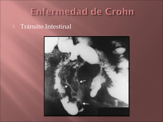    Tránsito Intestinal
 