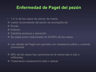 Enfermedad de Paget del pezón 1-4 % de los casos de cáncer de mama Lesión eccematoide del pezón se acompaña de:  Prurito  Eritema  Cambios erosivos y secreción  Se palpa tumor relacionado en 30-60% de los casos. Las células de Paget son grandes con citoplasma pálido y nucleolo prominente. 99% de los casos hay carcinoma en la mama sea in situ o infiltrantes.  Tratamiento mastectomía total o radical.  