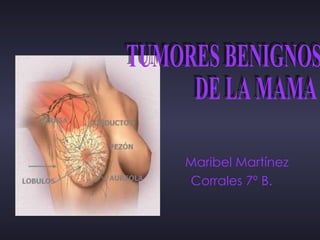 Maribel Martínez  Corrales 7º B.  TUMORES BENIGNOS  DE LA MAMA  