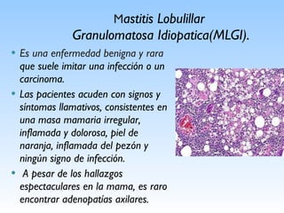 Patologia benigna de la mama | PPT