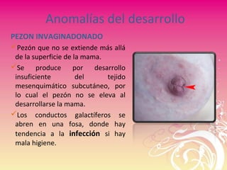 Anomalías del desarrollo
PEZON INVAGINADONADO
Pezón que no se extiende más allá
de la superficie de la mama.
Se produce por desarrollo
insuficiente del tejido
mesenquimático subcutáneo, por
lo cual el pezón no se eleva al
desarrollarse la mama.
Los conductos galactíferos se
abren en una fosa, donde hay
tendencia a la infección si hay
mala higiene.
 