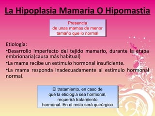 La Hipoplasia Mamaria O Hipomastia
Etiología:
•Desarrollo imperfecto del tejido mamario, durante la etapa
embrionaria(causa más habitual)
•La mama recibe un estímulo hormonal insuficiente.
•La mama responda inadecuadamente al estímulo hormonal
normal.
Presencia
de unas mamas de menor
tamaño que lo normal
Presencia
de unas mamas de menor
tamaño que lo normal
El tratamiento, en caso de
que la etiología sea hormonal,
requerirá tratamiento
hormonal. En el resto será quirúrgico
El tratamiento, en caso de
que la etiología sea hormonal,
requerirá tratamiento
hormonal. En el resto será quirúrgico
 