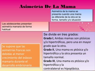 Asimetría De La Mama
Se supone que las
asimetrías francas son
debidas al menor
crecimiento del esbozo
mamario durante el
desarrollo embrionario
Se supone que las
asimetrías francas son
debidas al menor
crecimiento del esbozo
mamario durante el
desarrollo embrionario
Asimetría de la mama se
presenta cuando una mama
es diferente de la otra en la
forma, tamaño y/o situación
Asimetría de la mama se
presenta cuando una mama
es diferente de la otra en la
forma, tamaño y/o situación
Las adolescentes presentan
asimetría mamaria de forma
habitual
Las adolescentes presentan
asimetría mamaria de forma
habitual
Se divide en tres grados:
Grado I, Ambas mamas son ptósicas
y/o hipertróficas, pero una en mayor
grado que la otra.
Grado II, Una mama es ptósica y/o
hipertrófica y la otra presenta un
tamaño normal.
Grado III, Una mama es ptósica y/o
hipertrófica y la
contralateral es hipoplásica.
Se divide en tres grados:
Grado I, Ambas mamas son ptósicas
y/o hipertróficas, pero una en mayor
grado que la otra.
Grado II, Una mama es ptósica y/o
hipertrófica y la otra presenta un
tamaño normal.
Grado III, Una mama es ptósica y/o
hipertrófica y la
contralateral es hipoplásica.
 