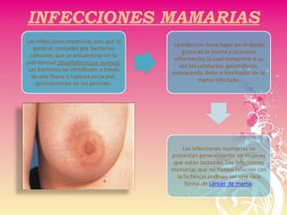 INFECCIONES MAMARIAS
 