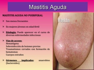 Mastitis AgudaMastitis Aguda
MASTITIS AGUDA NO PUERPERAL
 Son menos frecuentes
 En mujeres jóvenes en edad fértil
 Etiología: Puede aparecer en el curso de
diversas enfermedades infecciosas
 Vías de acceso:
Hematógena
Sobreinfección de lesiones previas
Traumatismos cerrados con formación de
hematomas
Cuerpos extraños
 Gérmenes implicados: anaerobios
(bacteroides)
 