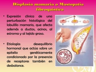 Displasia mamaria o MastopatiaDisplasia mamaria o Mastopatia
fibroquisticafibroquistica
• Expresión clínica de una
perturbación histológica del
lobulillo mamario, que afecta
además a ductos, acinos, al
estroma y al tejido graso.
• Etiología: desequilibrio
hormonal que actúa sobre un
epitelio genéticamente
condicionado por la presencia
de receptores también en
desbalance.
 