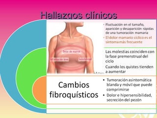 Hallazgos clínicosHallazgos clínicos
 