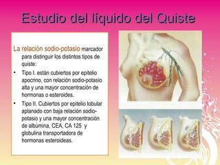 Estudio del líquido del QuisteEstudio del líquido del Quiste
La relación sodio-potasio marcador
para distinguir los distintos tipos de
quiste:
• Tipo I. están cubiertos por epitelio
apocrino, con relación sodio-potasio
alta y una mayor concentración de
hormonas o esteroides.
• Tipo II. Cubiertos por epitelio lobular
aplanado con baja relación sodio-
potasio y una mayor concentración
de albúmina, CEA, CA 125 y
globulina transportadora de
hormonas esteroideas.
 