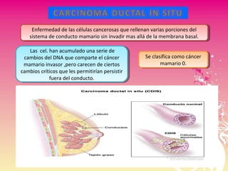 Se clasifica como cáncer
mamario 0.
Se clasifica como cáncer
mamario 0.
Enfermedad de las células cancerosas que rellenan varias porciones del
sistema de conducto mamario sin invadir mas allá de la membrana basal.
Enfermedad de las células cancerosas que rellenan varias porciones del
sistema de conducto mamario sin invadir mas allá de la membrana basal.
Las cel. han acumulado una serie de
cambios del DNA que comparte el cáncer
mamario invasor ,pero carecen de ciertos
cambios críticos que les permitirían persistir
fuera del conducto.
Las cel. han acumulado una serie de
cambios del DNA que comparte el cáncer
mamario invasor ,pero carecen de ciertos
cambios críticos que les permitirían persistir
fuera del conducto.
 