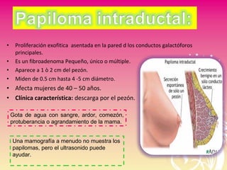 • Proliferación exofitica asentada en la pared d los conductos galactóforos
principales.
• Es un fibroadenoma Pequeño, único o múltiple.
• Aparece a 1 ò 2 cm del pezón.
• Miden de 0.5 cm hasta 4 -5 cm diámetro.
• Afecta mujeres de 40 – 50 años.
• Clínica característica: descarga por el pezón.
Gota de agua con sangre, ardor, comezón,
protuberancia o agrandamiento de la mama.
Una mamografía a menudo no muestra los
papilomas, pero el ultrasonido puede
ayudar.
 