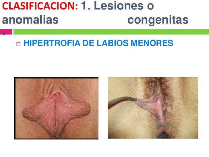 El tratamiento contra los granos sobre la persona la piel grasa