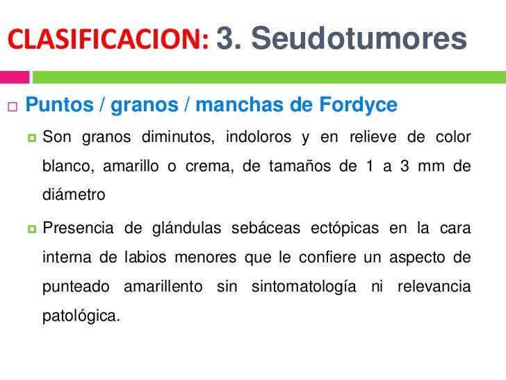 La dirección de los tiempos sobre la persona