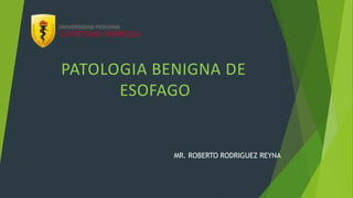 PATOLOGIA BENIGNA DE
ESOFAGO
MR. ROBERTO RODRIGUEZ REYNA
 
