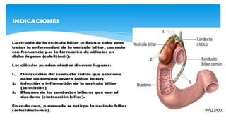 Patologia biliar 2 
