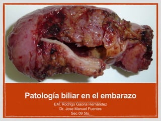 Patología biliar en el embarazo
EM. Rodrigo Gaona Hernández
Dr. Jose Manuel Fuentes
Sec 09 5to.
 
