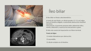 Triada Rigeler Patologia Biliar prete rminado.pptx
