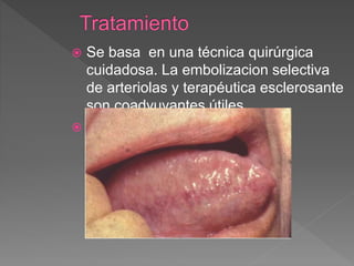  Se basa en una técnica quirúrgica
cuidadosa. La embolizacion selectiva
de arteriolas y terapéutica esclerosante
son coadyuvantes útiles.
 laser
 