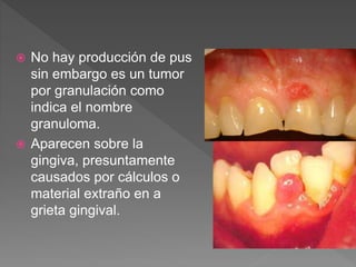  No hay producción de pus
sin embargo es un tumor
por granulación como
indica el nombre
granuloma.
 Aparecen sobre la
gingiva, presuntamente
causados por cálculos o
material extraño en a
grieta gingival.
 