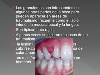  Los granulomas son infrecuentes en
algunas otras partes de la boca pero
pueden aparecer en áreas de
traumatismo frecuente como el labio
inferior, la mucosa bucal y la lengua.
 Son típicamente rojos
 Algunas veces se ulceran a causas de un
traumatismo secundario.
 la lesión ulcerada puede entonces
cubrirse con una membrana fibrosa de
color amarillo,
 es mas frecuente en mujeres que en
hombres
 