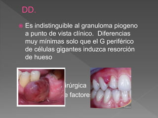  Es indistinguible al granuloma piogeno
a punto de vista clínico. Diferencias
muy mínimas solo que el G periférico
de células gigantes induzca resorción
de hueso
Tratamiento
 Resección quirúrgica
 Eliminación de factores locales o
irritantes
 
