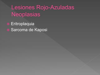  Eritroplaquia
 Sarcoma de Kaposi
 