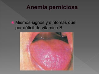  Mismos signos y síntomas que
por déficit de vitamina B
 