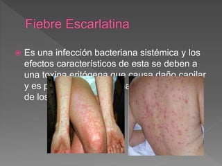  Es una infección bacteriana sistémica y los
efectos característicos de esta se deben a
una toxina eritógena que causa daño capilar
y es producida por algunas cepas del grupo
de los estreptococos A.
 