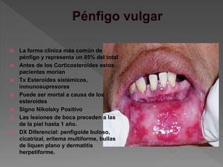  La forma clínica más común de
pénfigo y representa un 85% del total
 Antes de los Corticosteroides estos
pacientes morían
 Tx Esteroides sistémicos,
inmunosupresores
 Puede ser mortal a causa de los
esteroides
 Signo Nikolsky Positivo
 Las lesiones de boca preceden a las
de la piel hasta 1 año.
 DX Diferencial: penfigoide buloso,
cicatrizal, eritema multiforme, bullas
de liquen plano y dermatitis
herpetiforme.
 