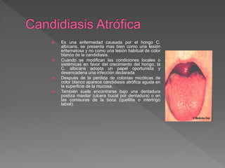  Es una enfermedad causada por el hongo C.
albicans, se presenta mas bien como una lesión
eritematosa y no como una lesión habitual de color
blanco de la candidiasis.
 Cuando se modifican las condiciones locales o
sistémicas en favor del crecimiento del hongo, la
C. albicans adopta un papel oportunista y
desencadena una infección declarada
 Después de la perdida de colonias micóticas de
color blanco aparece candidiasis atrófica aguda en
la superficie de la mucosa.
 También suele encontrarse bajo una dentadura
postiza maxilar (ulcera bucal por dentadura) o en
las comisuras de la boca (queilitis o intertrigo
labial).
 