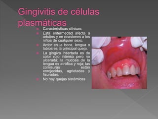  Características clínicas:
 Esta enfermedad afecta a
adultos y en ocasiones a los
niños de cualquier sexo.
 Ardor en la boca, lengua o
labios es la principal queja.
 La gingiva insertada es de
color rojo intenso pero no
ulcerada; la mucosa de la
lengua es atrófica y roja; las
comisuras están
enrojecidas, agrietadas y
fisuradas.
 No hay quejas sistémicas
 