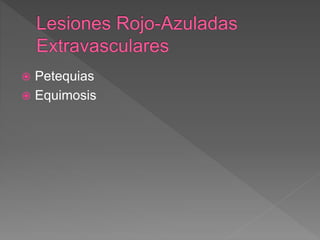  Petequias
 Equimosis
 