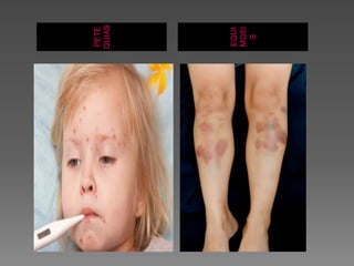 PETE
QUIAS
EQUI
MOSI
S
 