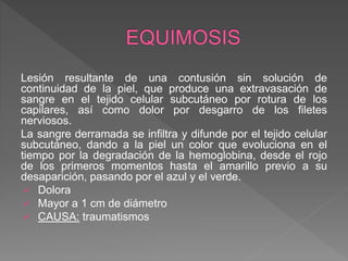 Lesión resultante de una contusión sin solución de
continuidad de la piel, que produce una extravasación de
sangre en el tejido celular subcutáneo por rotura de los
capilares, así como dolor por desgarro de los filetes
nerviosos.
La sangre derramada se infiltra y difunde por el tejido celular
subcutáneo, dando a la piel un color que evoluciona en el
tiempo por la degradación de la hemoglobina, desde el rojo
de los primeros momentos hasta el amarillo previo a su
desaparición, pasando por el azul y el verde.
 Dolora
 Mayor a 1 cm de diámetro
 CAUSA: traumatismos
 
