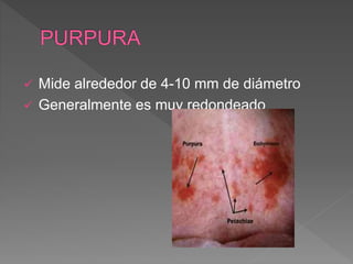  Mide alrededor de 4-10 mm de diámetro
 Generalmente es muy redondeado
 