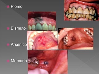  Plomo
 Bismuto
 Arsénico
 Mercurio
 