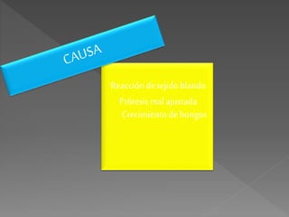 Reacciónde tejidoblando
Prótesis malajustada
Crecimientodehongos
 