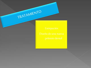 Extirpación
Diseñodeuna nueva
prótesisdental
 