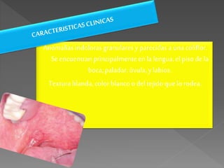 Anomalíasindolorasgranulares yparecidas a una coliflor.
Se encuentranprincipalmenteen la lengua,elpisode la
boca, paladar,úvula, y labios.
Texturablanda,color blanco odeltejidoquelorodea.
 