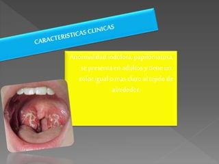 Anormalidadindolora,papilomatosa,
se presentaen adultosy tieneun
color igualomasclaro altejidode
alrededor.
 