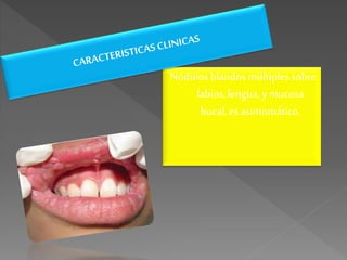Nódulosblandosmúltiplessobre
labios,lengua,y mucosa
bucal, es asintomático.
 