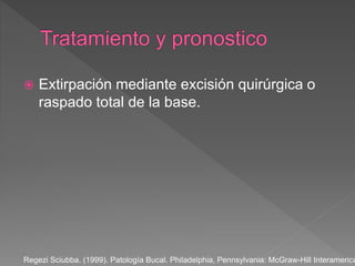  Extirpación mediante excisión quirúrgica o
raspado total de la base.
Regezi Sciubba. (1999). Patología Bucal. Philadelphia, Pennsylvania: McGraw-Hill Interamerica
 