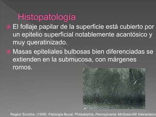  El follaje papilar de la superficie está cubierto por
un epitelio superficial notablemente acantósico y
muy queratinizado.
 Masas epiteliales bulbosas bien diferenciadas se
extienden en la submucosa, con márgenes
romos.
Regezi Sciubba. (1999). Patología Bucal. Philadelphia, Pennsylvania: McGraw-Hill Interamerica
 
