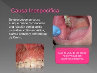Se desconoce su causa,
aunque puede reconocerse
una relación con la colitis
ulcerativa, colitis espástica,
diarrea crónica y enfermedad
de Crohn.
Mas de 25% de los casos
no se vincula con
trastornos digestivos.
 