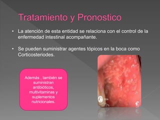 • La atención de esta entidad se relaciona con el control de la
enfermedad intestinal acompañante.
• Se pueden suministrar agentes tópicos en la boca como
Corticosteriodes.
Además , también se
suministran
antibióticos,
multivitaminas y
suplementos
nutricionales.
 