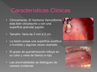 • Clínicamente: El Xantoma Verruciforme
esta bien circunscrito y con una
superficie granular papilar.
• Tamaño: Varia de 2 mm a 2 cm.
• La lesión posee una superficie exofitica
o hundida y algunas veces ulcerada.
• El grado de queratinización influye en
su color y varia de blanco a rojo.
• Las anormalidades se distinguen de
manera incidental.
 