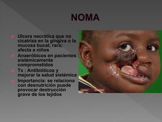  Ulcera necrótica que no
cicatriza en la gingiva o la
mucosa bucal; rara;
afecta a niños
 Anaeróbicos en pacientes
sistémicamente
comprometidos
 Tx : Antibióticos y
mejorar la salud sistémica
 Importancia: se relaciona
con desnutrición puede
provocar destrucción
grave de los tejidos
 