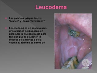  Las palabras griegas leuco-,
"blanco" y dema, "hinchazón".
 Leucoedema es un aspecto azul,
gris o blanco de mucosas, en
particular la mucosa bucal, pero
también puede ocurrir en la
mucosa de la laringe o de la
vagina. El término se deriva de
 