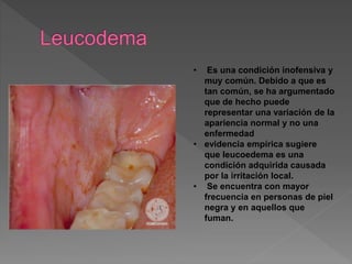 • Es una condición inofensiva y
muy común. Debido a que es
tan común, se ha argumentado
que de hecho puede
representar una variación de la
apariencia normal y no una
enfermedad
• evidencia empírica sugiere
que leucoedema es una
condición adquirida causada
por la irritación local.
• Se encuentra con mayor
frecuencia en personas de piel
negra y en aquellos que
fuman.
 