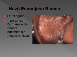  TX: Ninguno
 Importancia:
Permanece de
manera
indefinida sin
efectos nocivos.
 