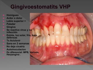  Homigueo
 Ardor o dolor
 Labio superior +
 Paladar
 Gingiva
 Se reactiva virus y no
infección
 Estrés, luz solar, frio, baja
defensas
 Tx Aciclovir
 Sana en 2 semanas
 No deja cicatriz
 Autoinoculacion
 Dx diferencial: MPB, Varicela,
Herpangina .

 